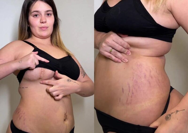 Viih Tube impressiona web ao mostrar corpo pós-parto: ‘estava bem pior’