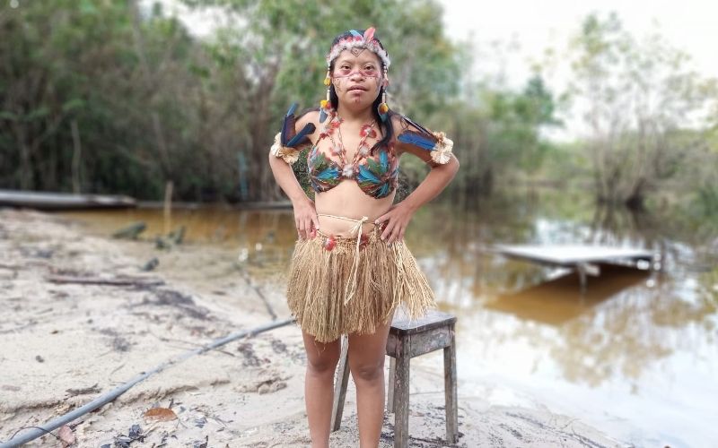 Crianças com Síndrome de Down no Território Munduruku