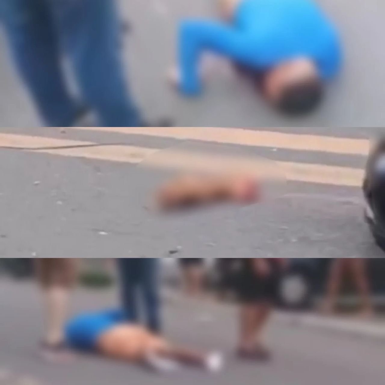 Foto: Divulgação Motociclista sofre grave acidente e tem mão decepada na Zona Norte de Manaus