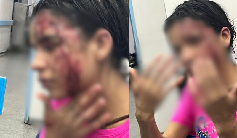 Jovem é brutalmente espancada após recusar a ficar com homem em Manaus Jovem é brutalmente espancada após recusar a ficar com homem em Manaus